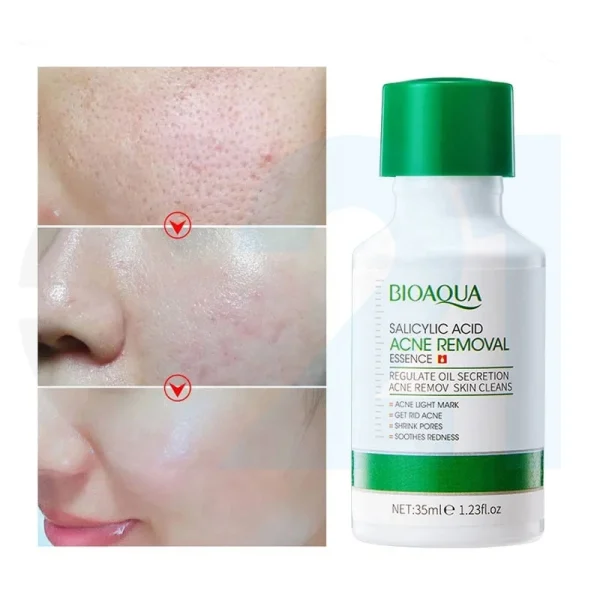 تونر ضد جوش سالیسیلیک اسید Bioaqua - Image 2